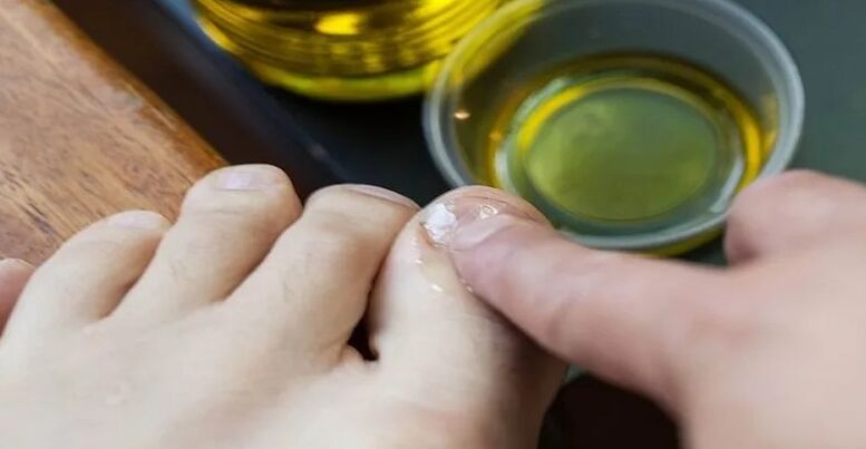 Essential oils to combat fungi